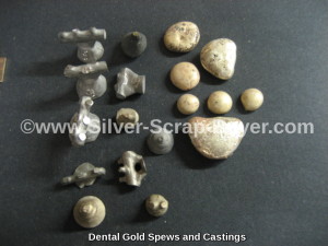 Dental gold spews and castings 